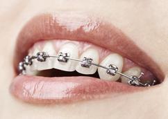 dental-care-coquitlam