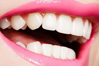 dental-care-coquitlam-long-term-care-mouth-sm-320x214